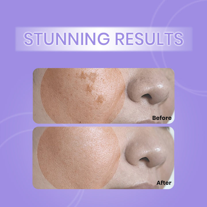 Dark Spot Corrector