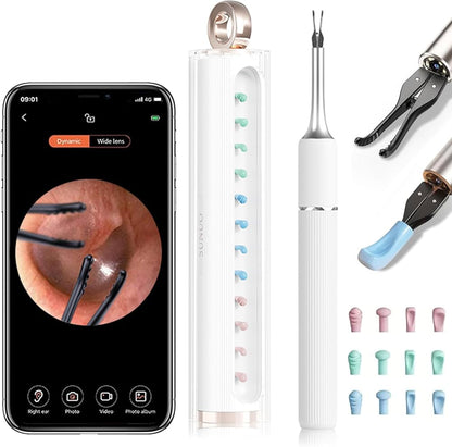 ClearView™ Smart Ear Cleaner Camera