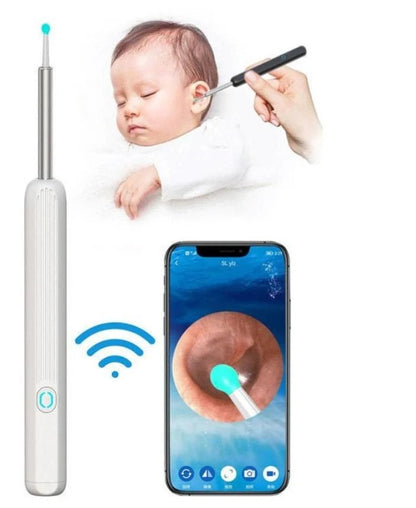 ClearView™ Smart Ear Cleaner Camera